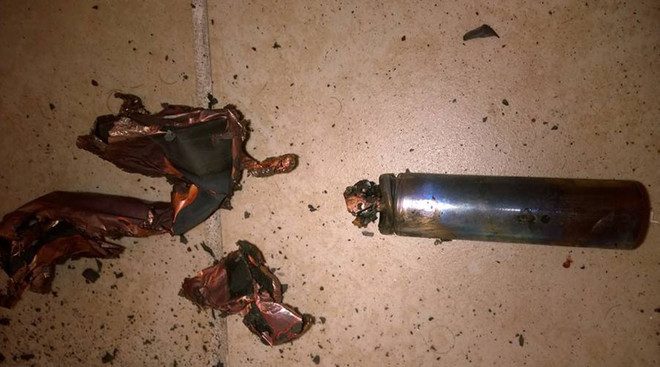 Mất 7 chiếc răng vì thuốc lá điện tử bất ngờ phát nổ trên miệng ảnh 1