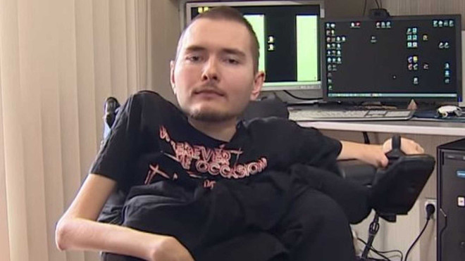 Bác sỹ tuyên bố phẫu thuật ghép đầu thành công trên thi thể người ảnh 2