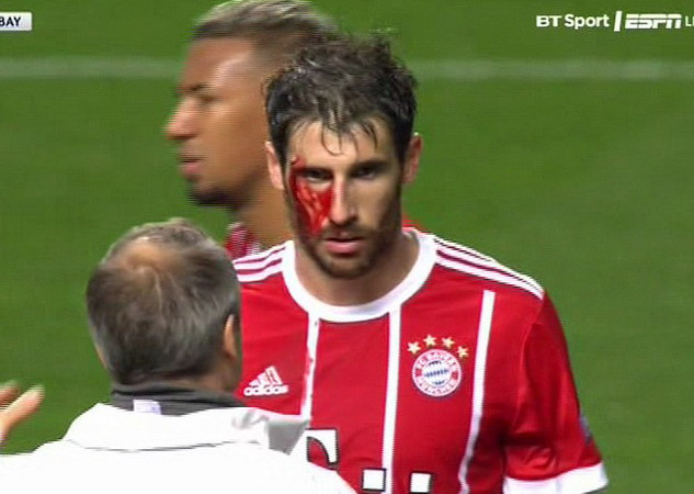 Cận cảnh Bayern Munich "đổ máu" giành vé vào vòng knock-out ảnh 1