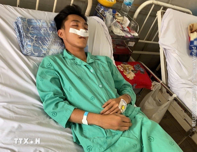 Nam sinh đang được điều trị tại bệnh viện. (Ảnh: TTXVN phát)