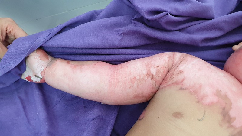 Ảnh minh họa. (Nguồn: AP)