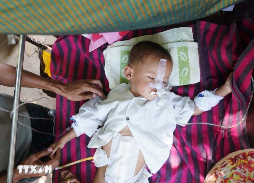 Điều trị cho em nhỏ bị thương trong trận động đất tại bệnh viện ở Nay Pyi Taw (Myanmar), ngày 31/3/2025. (Ảnh: THX/TTXVN)