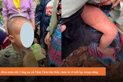 Cháu bé được tìm thấy với nhiều vết xước trên cơ thể. (Nguồn: Công an tỉnh Lai Châu)