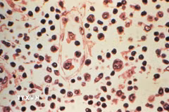 Mẫu bệnh phẩm của một bệnh nhân nhiễm virus Hanta. (Ảnh: Reuters/TTXVN)