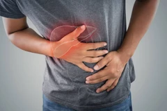 (Ảnh: iStock)