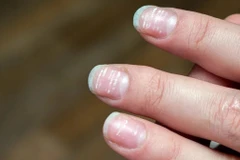 Đừng chủ quan với những dấu hiệu bất thường trên móng tay của bạn. (Ảnh: Getty)