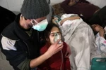 Thường dân Syria được điều trị triệu chứng khó thở sau các cuộc oanh kích được cho là sử dụng vũ khí hóa học. (Nguồn: AFP/ TTXVN)