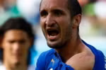 Ảnh vết răng của Suarez trên vai Chiellini là hình photoshop?