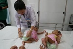 Hai bé gái song sinh Điểu Thị Bảo Ân và Điểu Thị Bảo Hân sau khi phẫu thuật tách dính thành công. (Ảnh: Phương Vy/TTXVN)