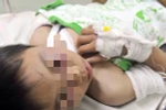 Bé trai bị cha dượng bạo hành đang trong tình trạng nguy hiểm