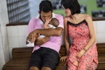 Một cặp vợ chồng trẻ chăm sóc con trai 2 tháng tuổi bị mắc chứng bệnh teo não do virus Zika tại bệnh viện ở Salvador, Brazil ngày 27/1. (Ảnh: AFP/TTXVN)