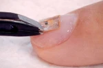 Vi chip biến móng tay thành danh thiếp kỹ thuật số.(Nguồn: odditycentral.com)