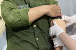 Thượng úy Hoàng Văn Dương bị thương ở cánh tay trái. (Ảnh công an cung cấp)