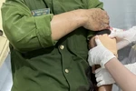 Thượng úy Hoàng Văn Dương bị thương ở cánh tay trái. (Ảnh công an cung cấp)