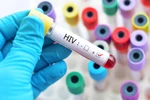 Ảnh minh họa. (Nguồn: Medical News Today)