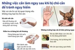 Những việc cần làm sau khi bị chó cắn để tránh nguy hiểm