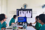 Các bác sỹ hội chẩn cho một trường hợp mắc bệnh COVID-19. (Ảnh: PV/Vietnam+)