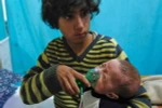 Trẻ em Syria phải sử dụng thiết bị cấp ôxy để thở sau một vụ tấn công bị nghi sử dụng khí độc tại Douma, Đông Ghouta ngày 22/1. (Nguồn: AFP/TTXVN)