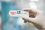 Công ty Australia được cấp phép cung cấp bộ xét nghiệm nhanh ở châu Âu
