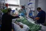 Nhân viên y tế điều trị cho bệnh nhân COVID-19 tại trung tâm y tế ở Tarzana, California, Mỹ. (Ảnh: AFP/TTXVN)