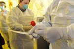 Thiết bị xét nghiệm phát hiện virus SARS-CoV-2 gây dịch viêm đường hô hấp cấp COVID-19 được sử dụng tại bệnh viện Newton-Wellesley ở Newton, bang Massachusetts, Mỹ ngày 18/3/2020. (Ảnh: AFP/TTXVN)