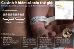[Infographics] Người phụ nữ Mali gây sốc khi sinh cùng lúc 9 em bé