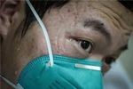 Dấu ấn cuộc chiến COVID-19 hằn sâu trên khuôn mặt người trong cuộc