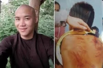 Bình Thuận: Bé trai nghi bị bạo hành sau khi tham dự 'khóa tu'