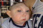 Khi sinh ra Jaxon Emmett Buell bị thiếu mất phần lớn não bộ và hộp sọ. (Nguồn: Daily Mail)