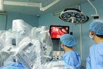 Các bác sỹ Bệnh viện Bình Dân dùng robot phẫu thuật cứu thai phụ khỏi nguy cơ sốc nhiễm trùng đường mật do sỏi ống mật chủ diễn tiến viêm tụy cấp. (Ảnh: TTXVN phát)