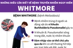 [Infographics] Những điều cần biết về căn bệnh nguy hiểm Whitmore