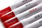 Phát hiện thuốc điều trị ung thư phổi có thể tiêu diệt các tế bào HIV