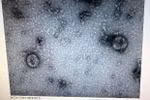 Viện vệ sinh dịch tễ Trung ương đã nuôi cấy và phân lập thành công virus corona mới. (Nguồn: Bộ Y tế)