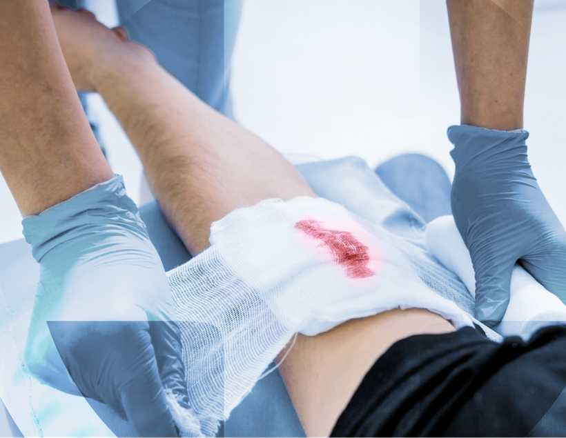 Các nhà nghiên cứu từ Australia, Nhật Bản, Anh và Mỹ đã sử dụng huyết tương để phát triển phương pháp điều trị hiệu quả hơn cho các vết thương lâu lành. (Nguồn: Netcare)