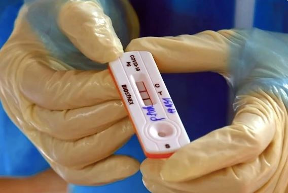 Kết quả xét nghiệm COVID-19. (Nguồn: Vietnam+) 