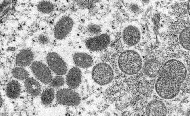 Hình ảnh virus đậu mùa khỉ dưới kính hiển vi điện tử. (Ảnh: AFP/TTXVN) Nhật Bản ghi nhận trường hợp đầu tiên mắc bệnh đậu mùa khỉ ảnh 1