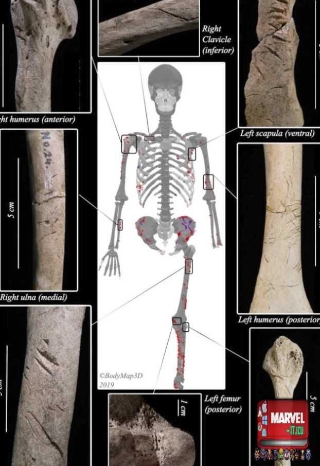 Phát hiện người đầu tiên bị cá mập cắn chết cách đây 3000 năm ảnh 2