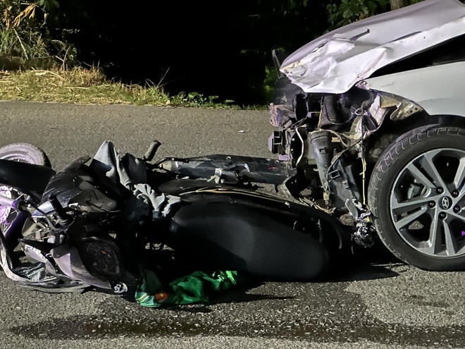 Chấn thương sọ não đứng đầu nhóm nguy cơ tử vong do tai nạn giao thông ảnh 1