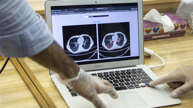 Iran công bố hệ thống chẩn đoán COVID-19 dựa trên công nghệ AI ảnh 1