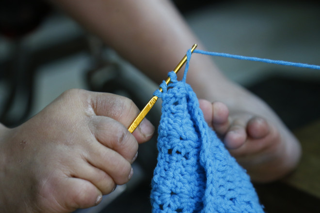 Đôi bàn chân khéo léo của cô gái da cam với nghị lực phi thường ảnh 3