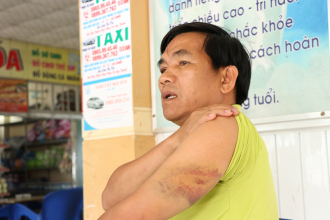 Đắk Nông: Điều tra Chánh Văn phòng Huyện ủy Tuy Đức hành hung lái xe ảnh 2