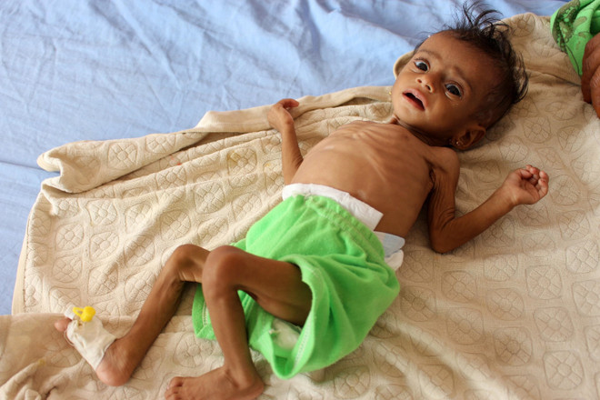 Tình hình dịch sáng 11/9: Thế giới ghi nhận hơn 913.000 ca tử vong ảnh 2