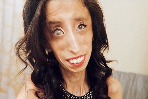 Nghị lực phi thường của "người phụ nữ xấu nhất thế giới" ảnh 2