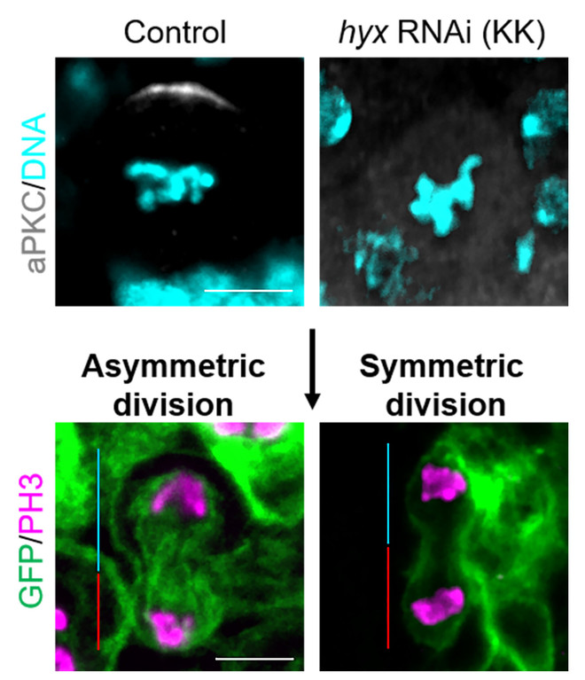 Tìm hiểu những bí mật của bệnh ung thư thông qua ruồi giấm ảnh 2