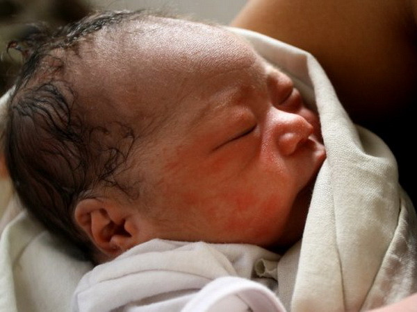 Ngày 27/7, dân số Philippines sẽ đạt mốc 100 triệu người ảnh 1