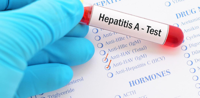 Ảnh minh họa (Nguồn: Buoyhealth) Mỹ: Bang Pennsylvania công bố bùng phát dịch viêm gan A ảnh 1