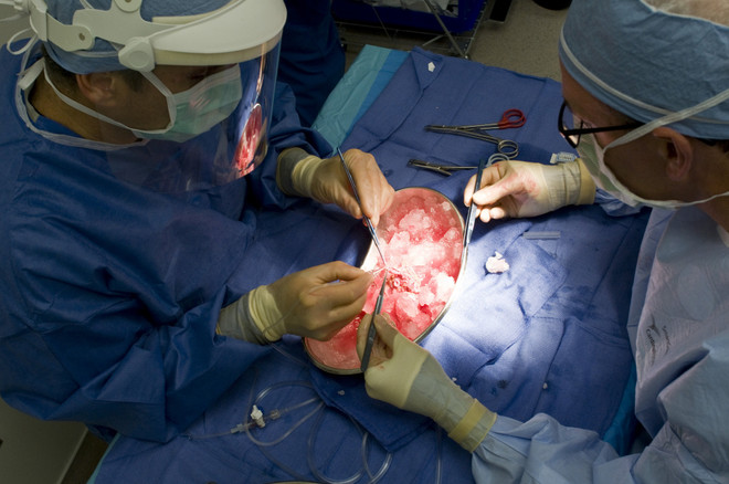 Nâng cao mức độ thành công khi tiến hành cấy ghép nội tạng ảnh 1