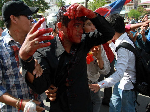 Campuchia buộc tội 5 nghị sỹ CNRP tổ chức biểu tình bạo lực ảnh 1