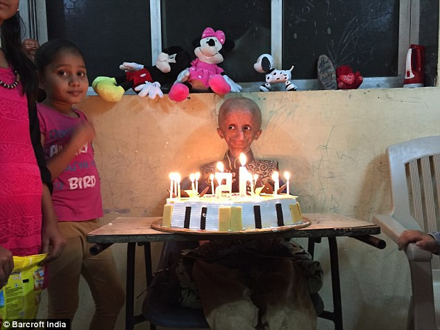 Chuyện lạ: Thiếu niên 15 tuổi phải sống trong cơ thể một cụ già ảnh 1