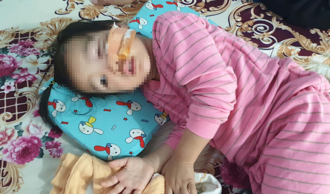 Bình Phước: Bé 3 tuổi bị hai con chó Becgie nhà hàng xóm cắn bị thương ảnh 1